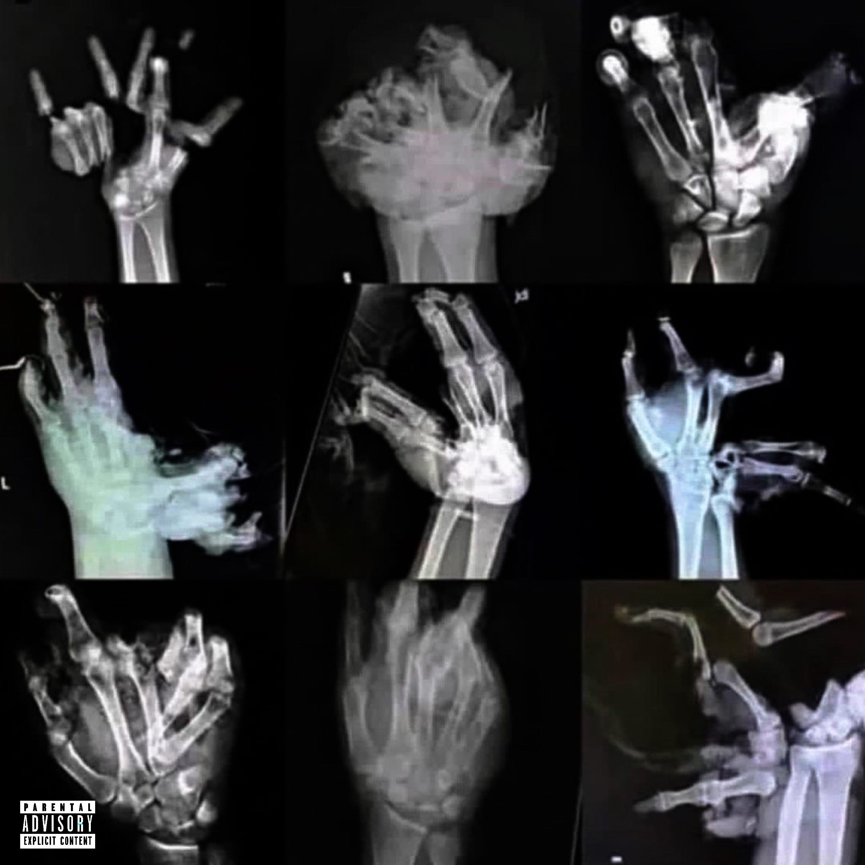 CB4YW artwork