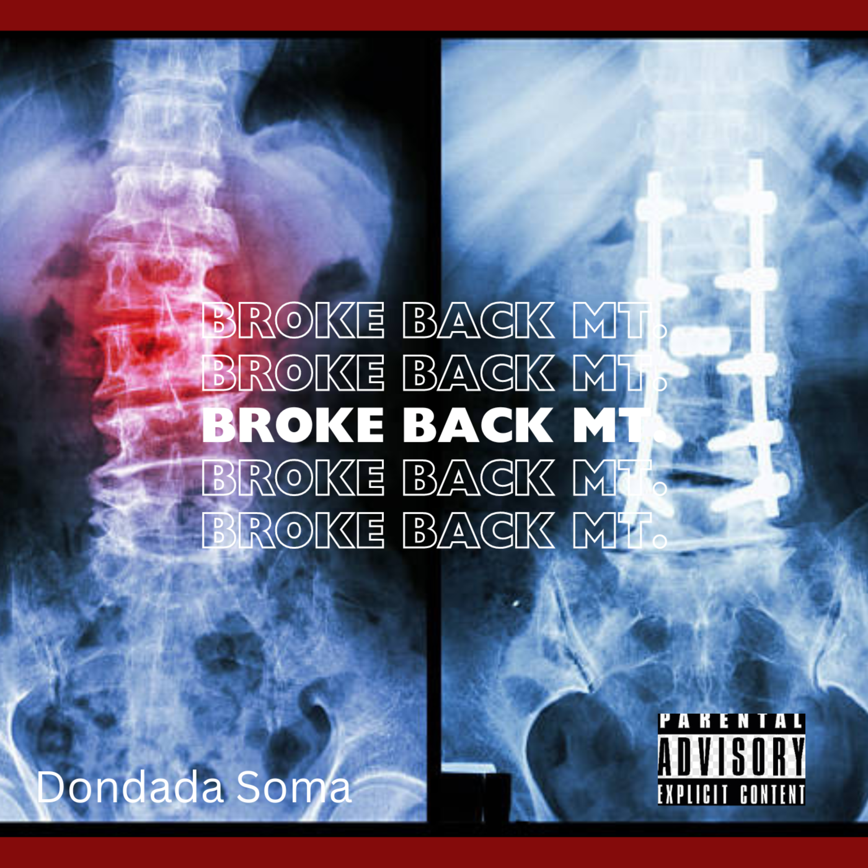 Broke Back Mountain by SOMAFROMDATRAP cover art