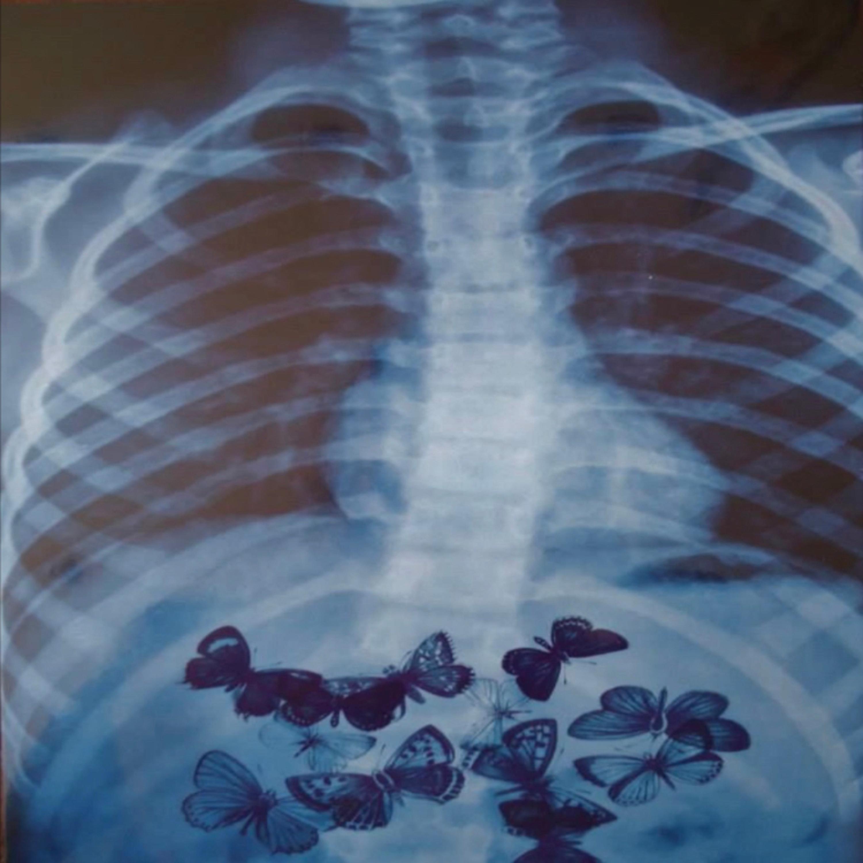 butterflies artwork