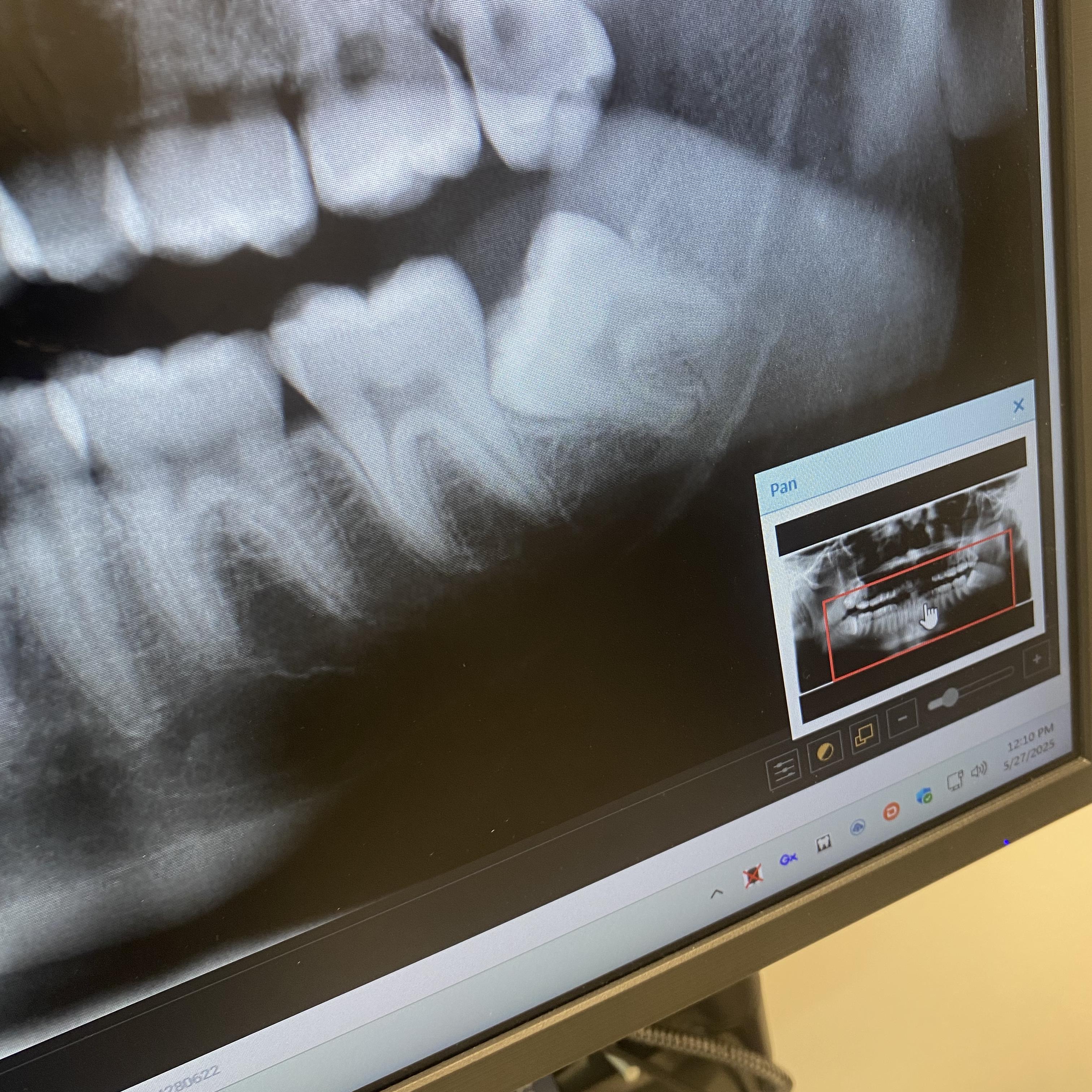 Voice Of A Skeleton artwork