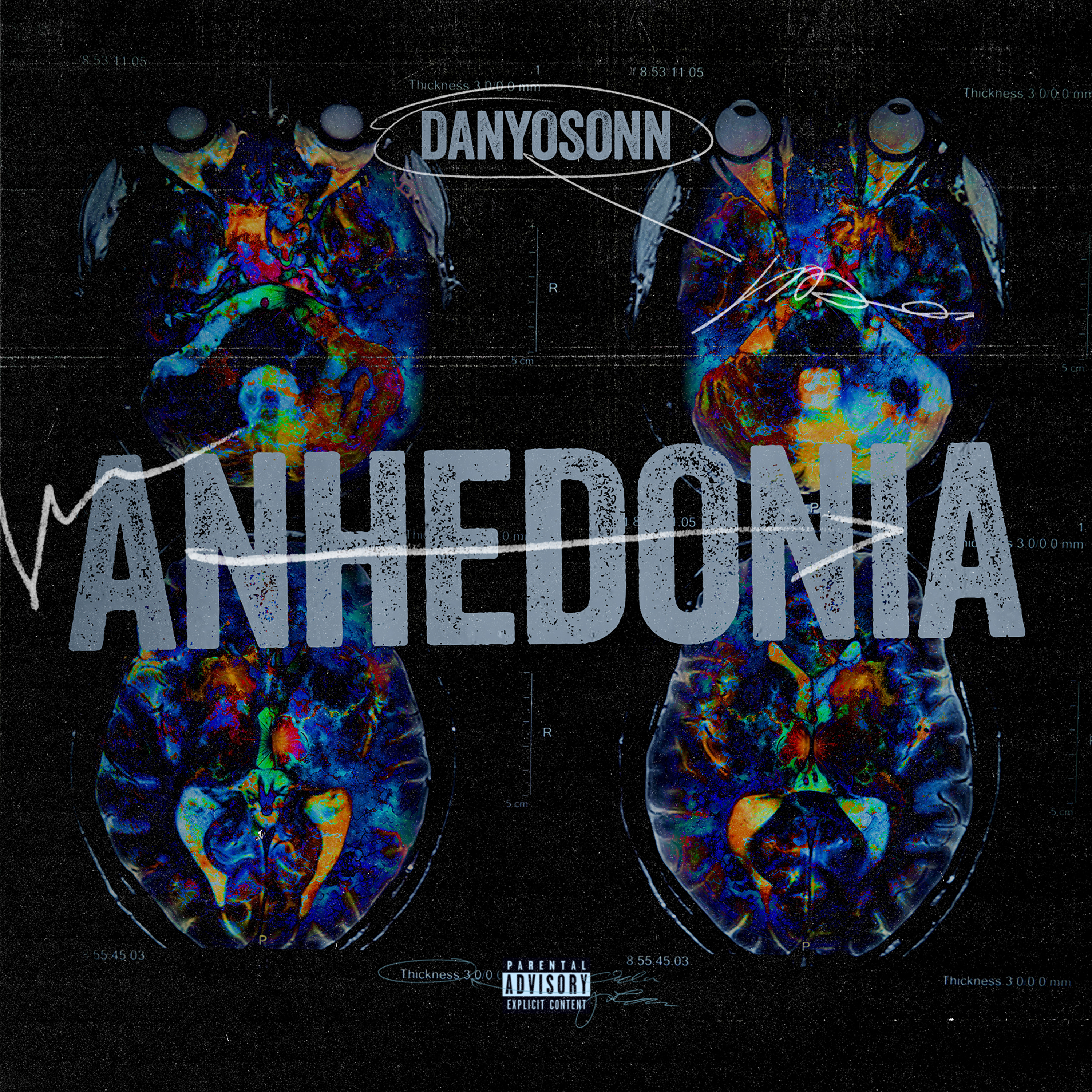 ANHEDONIA artwork