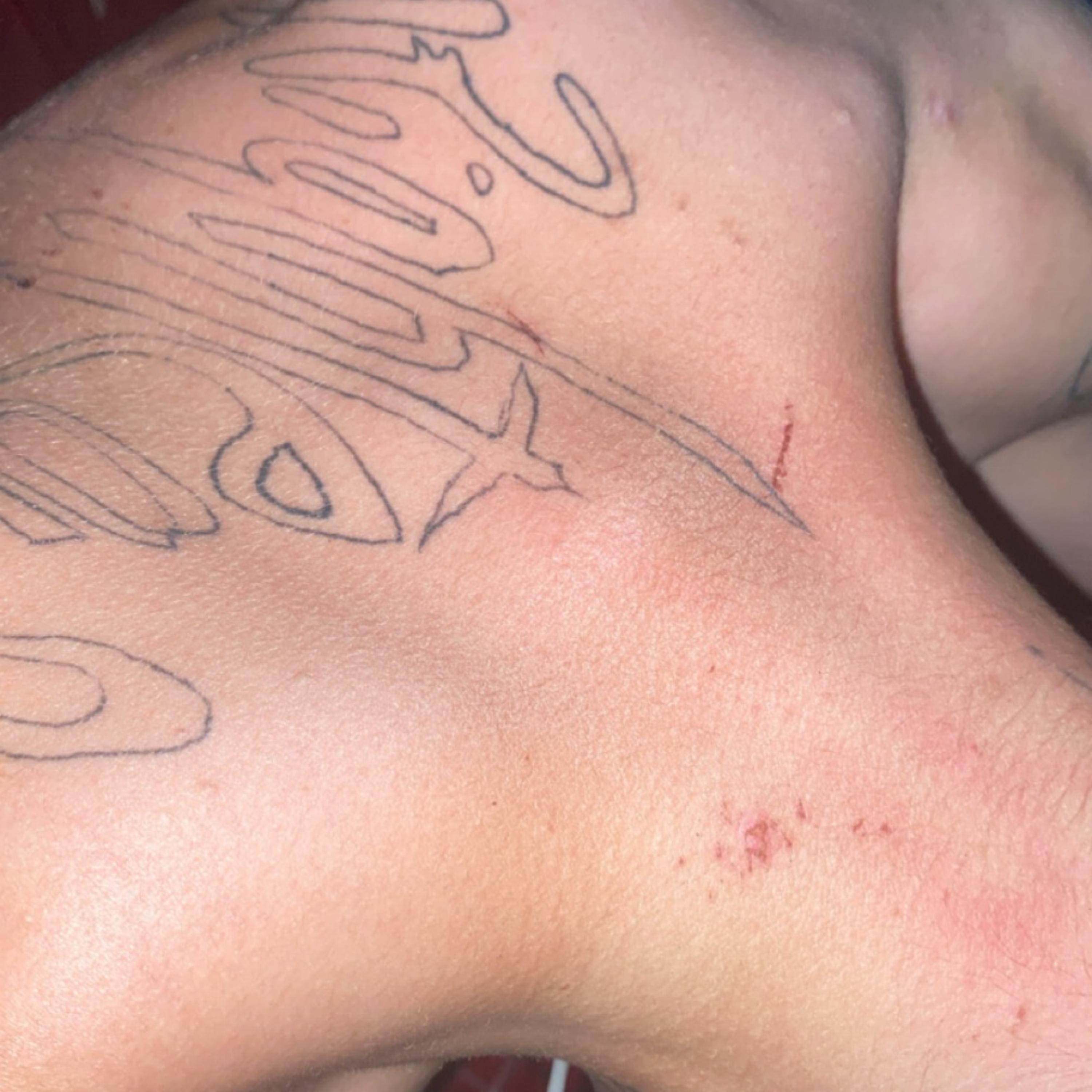 battle scars artwork