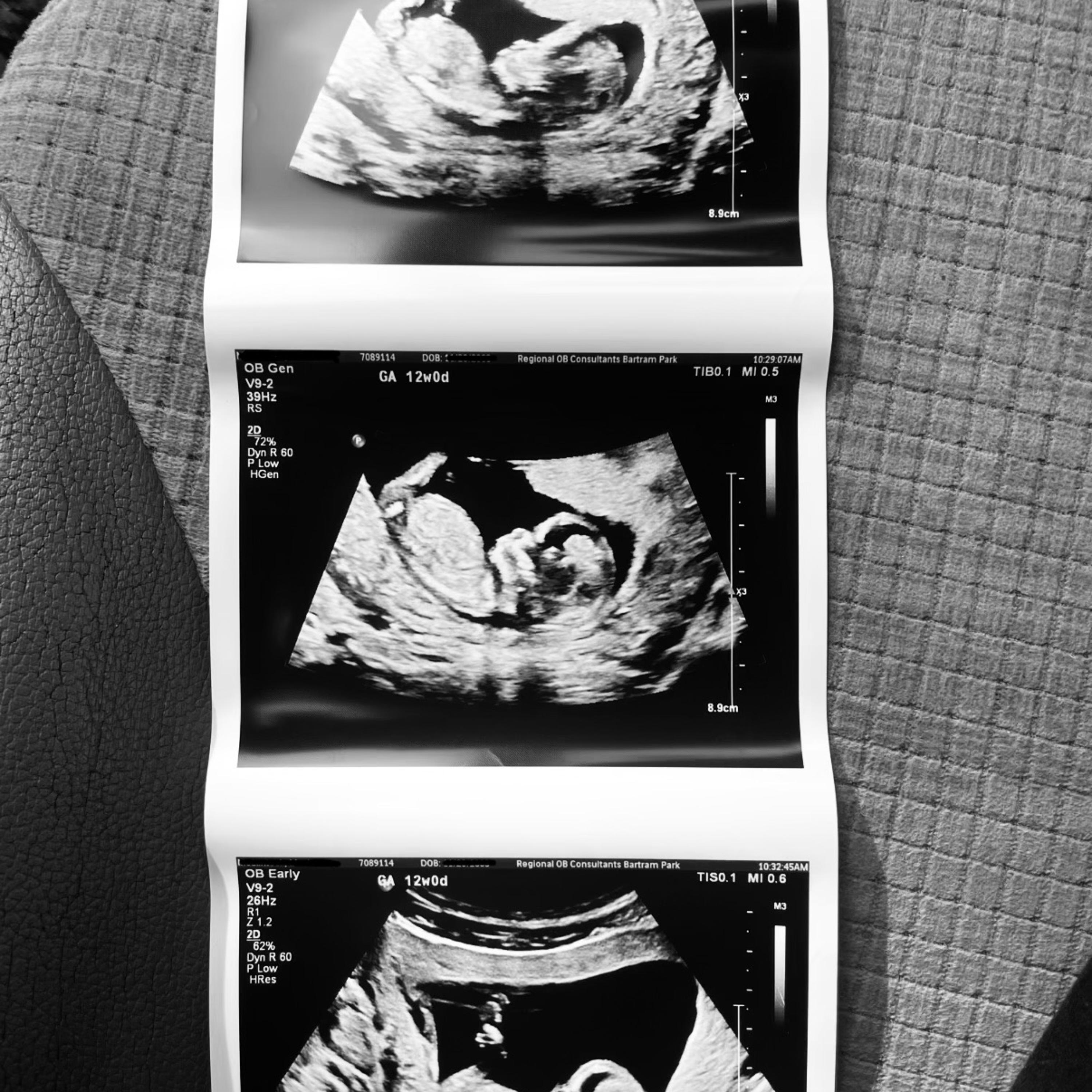 For My Unborn artwork