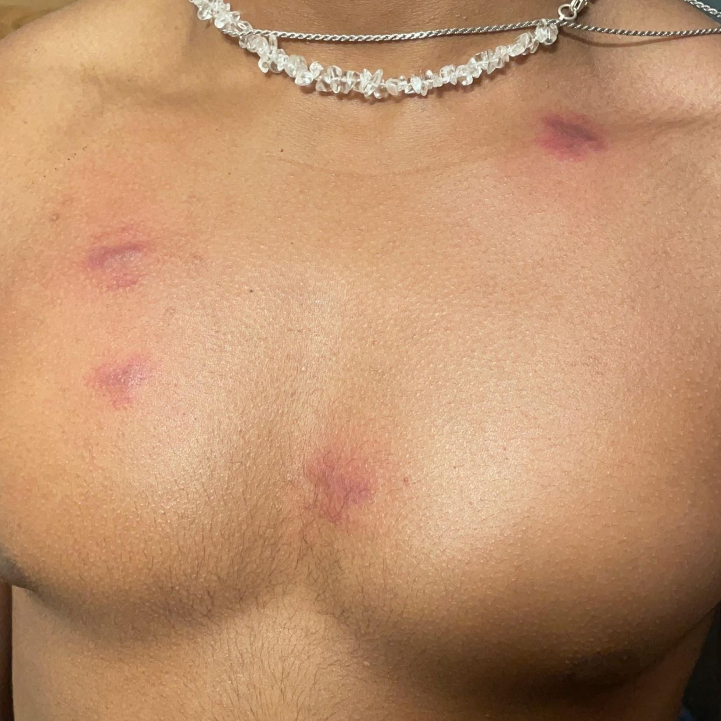 FREE DROWZZY artwork