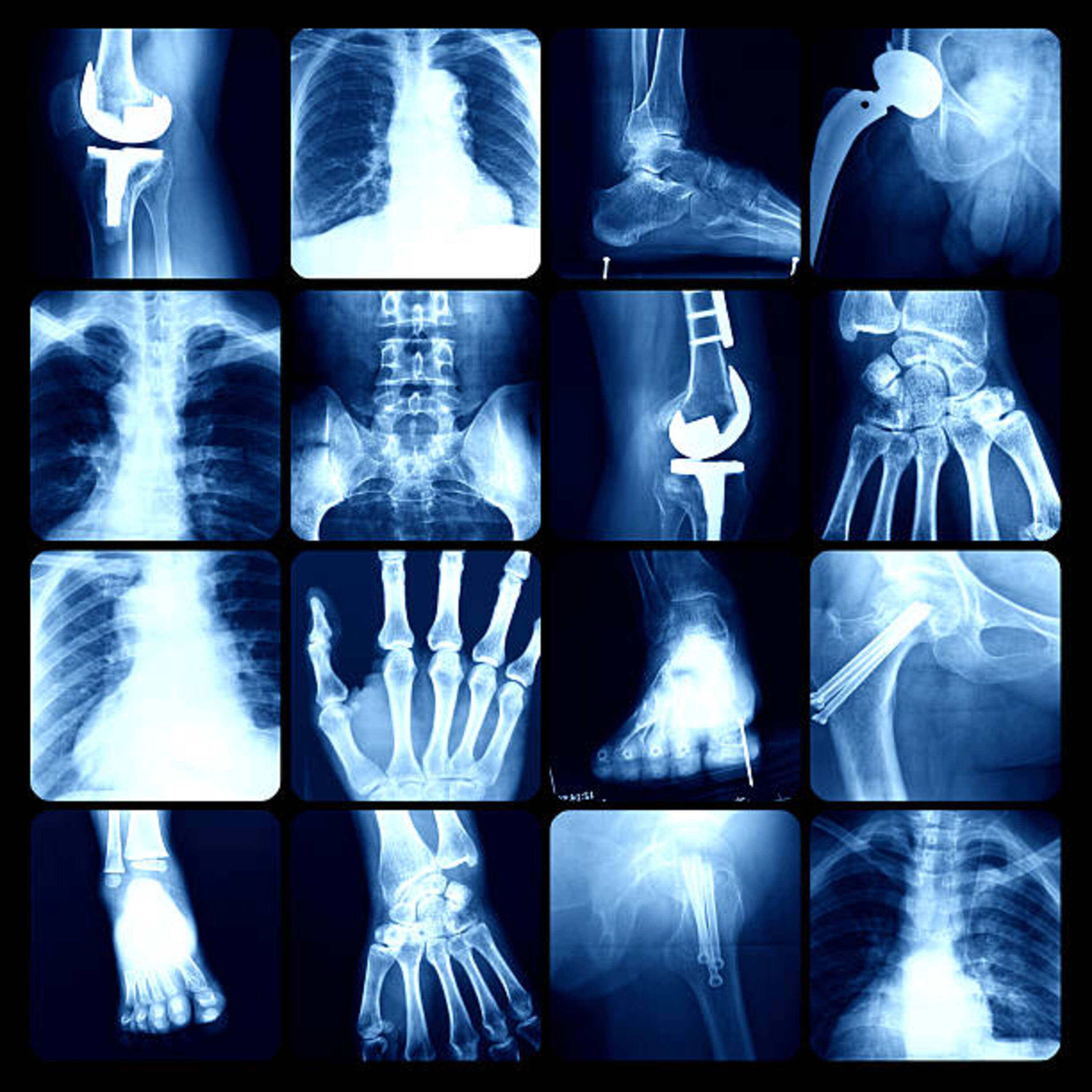 backbone artwork