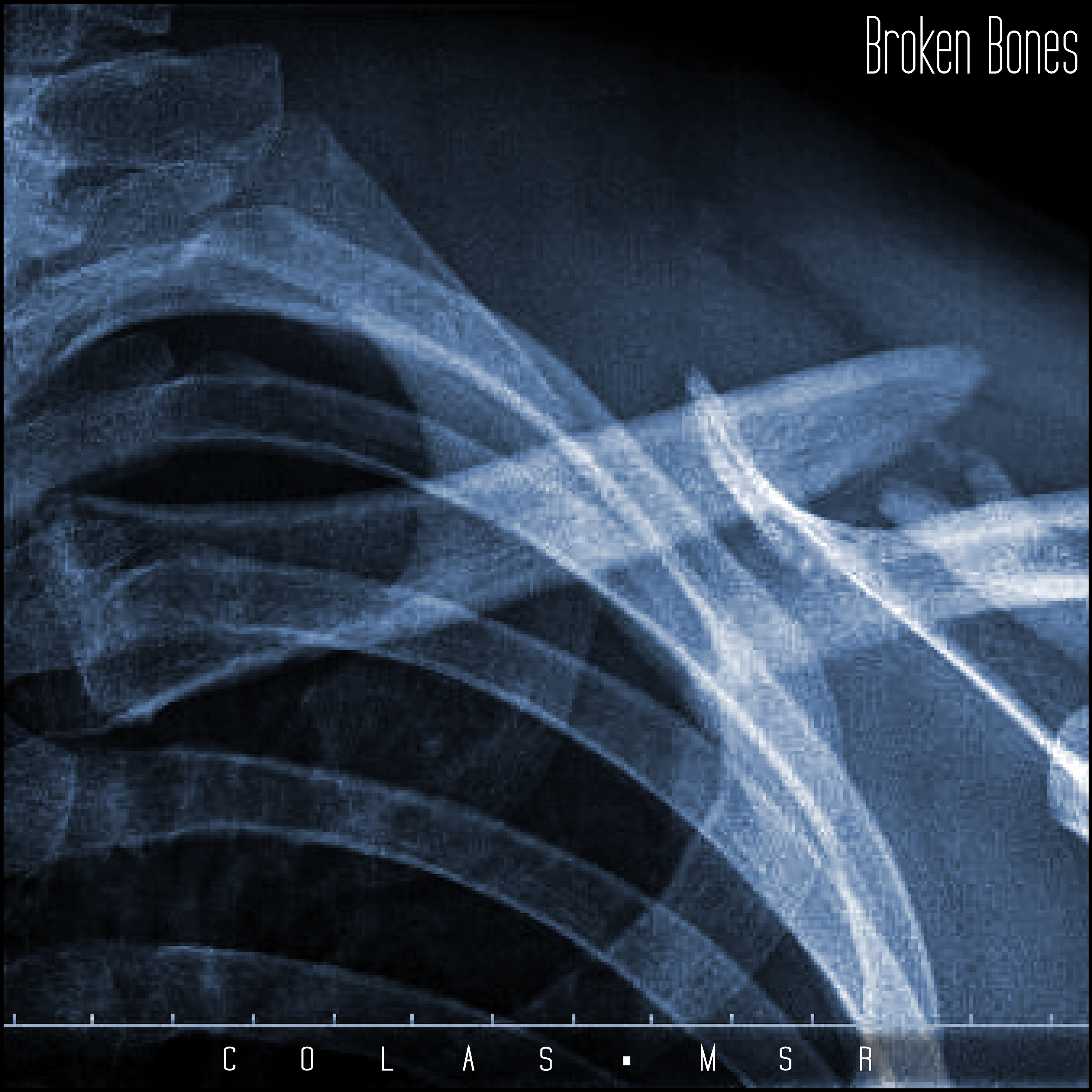 Broken Bones artwork