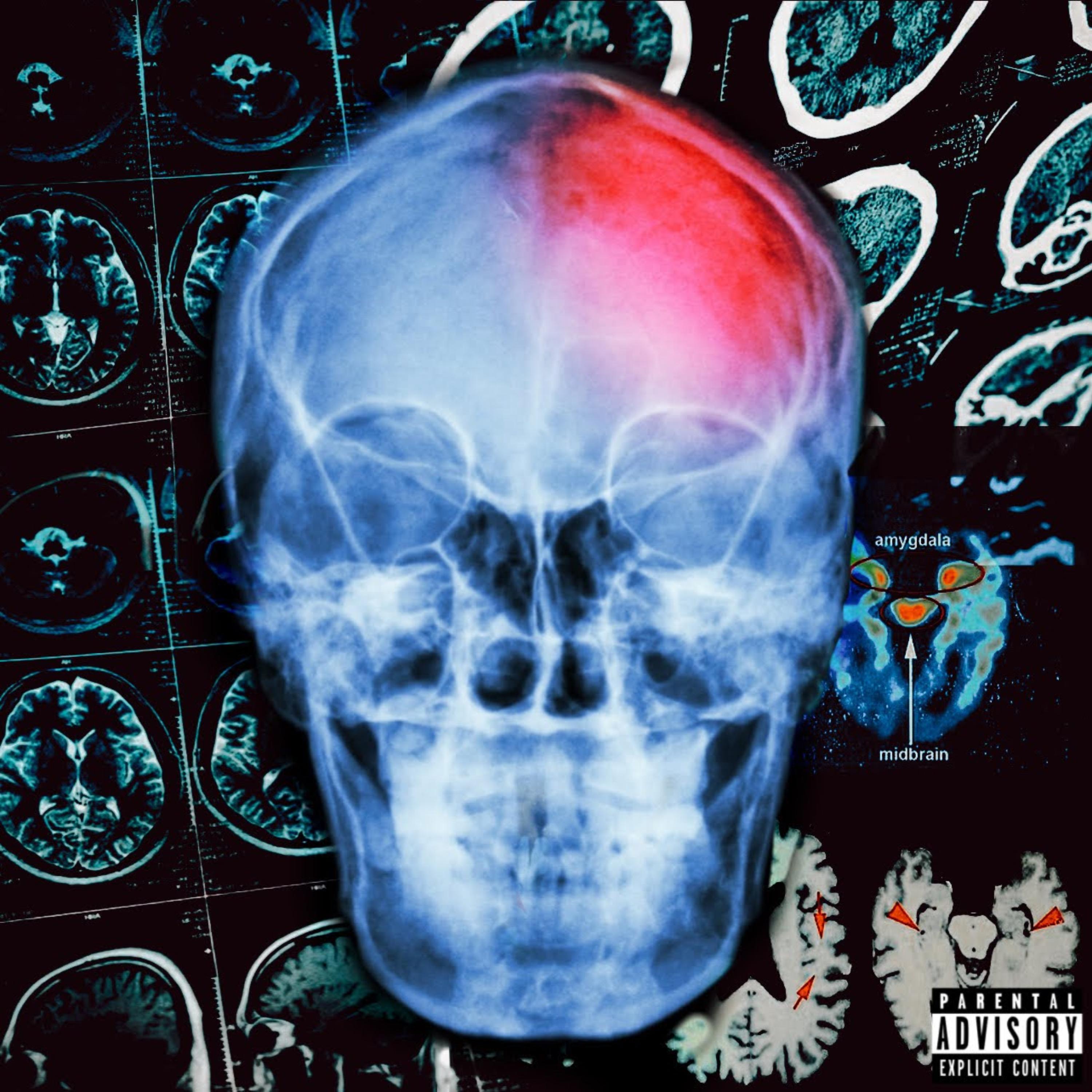 CTE artwork