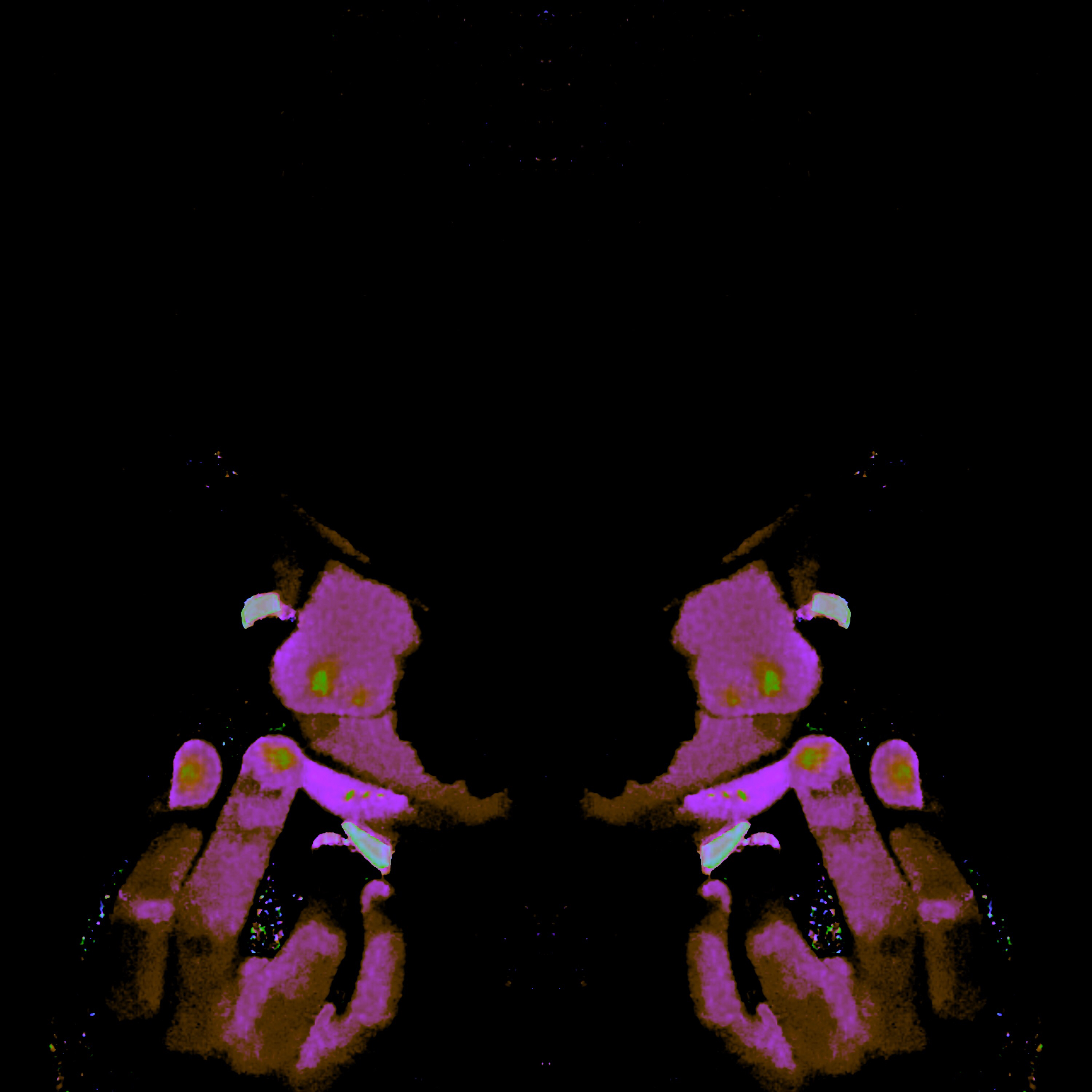wokeuplikethis artwork