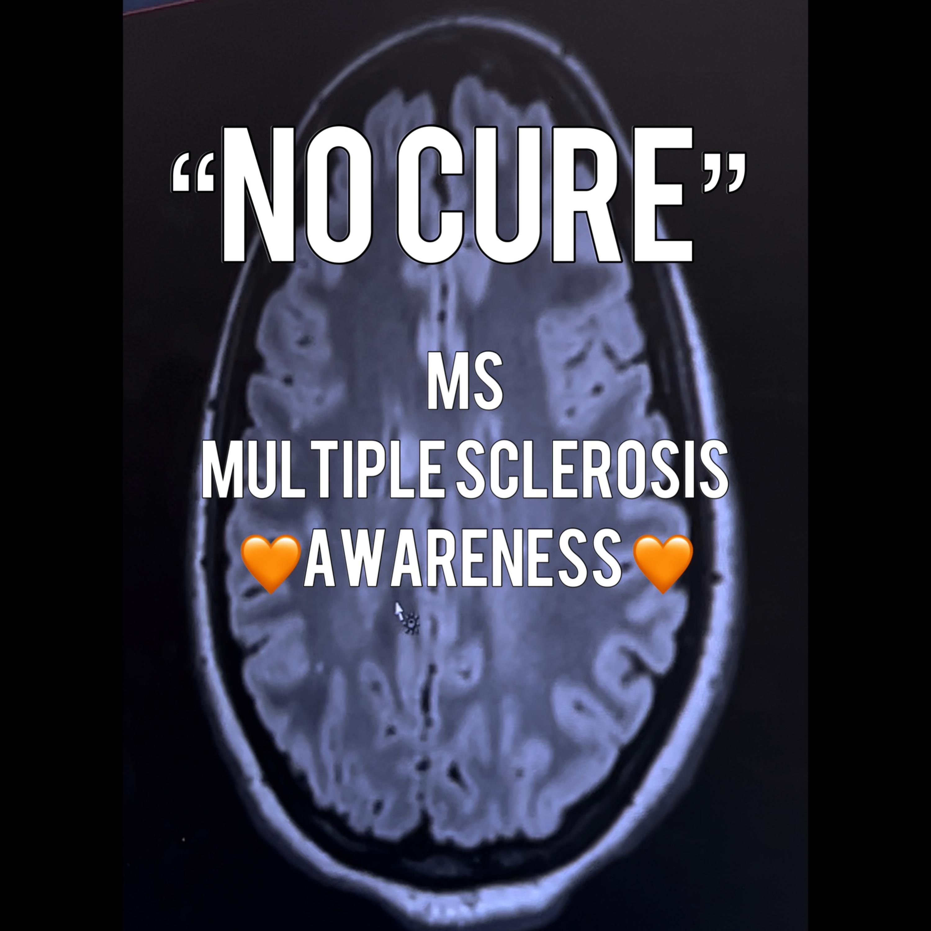 NO CURE (MS Awareness) artwork