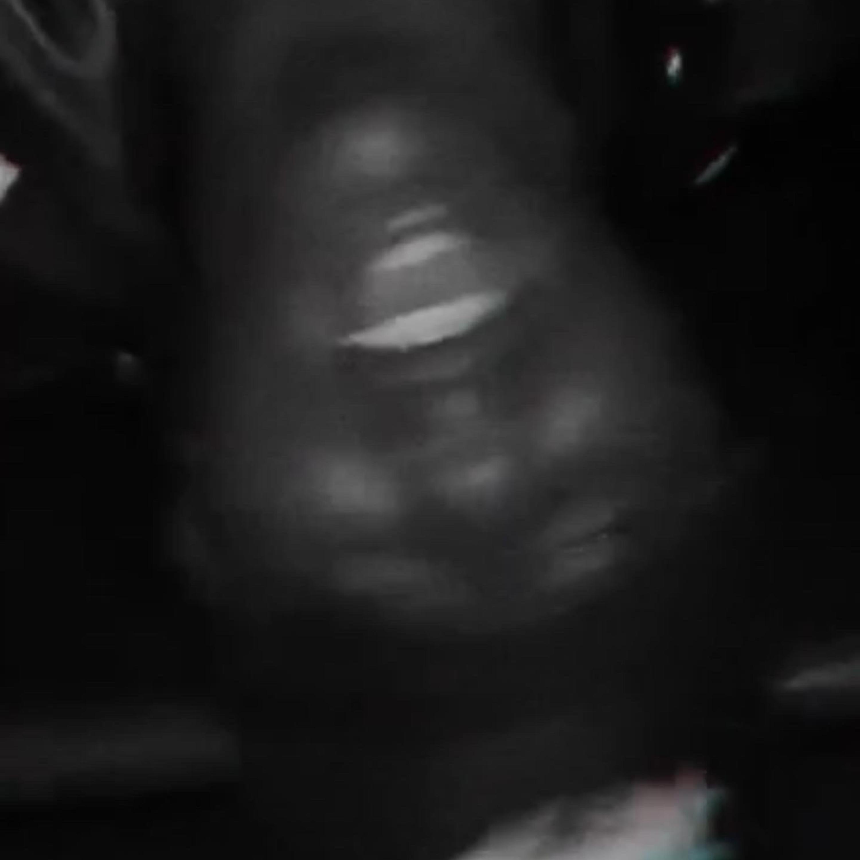 Lxst Bxys In A Dark Place artwork