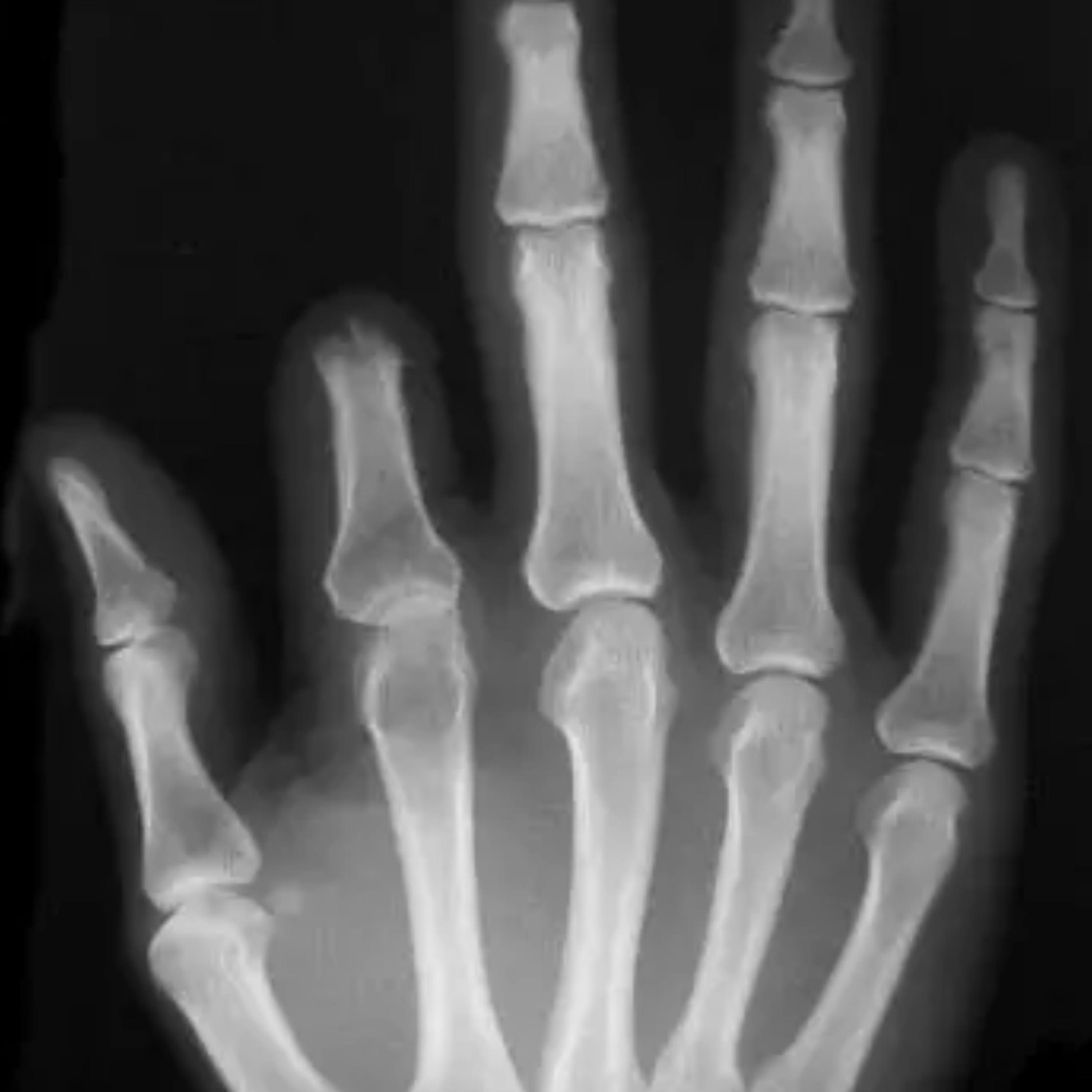 Thou Art Driven artwork