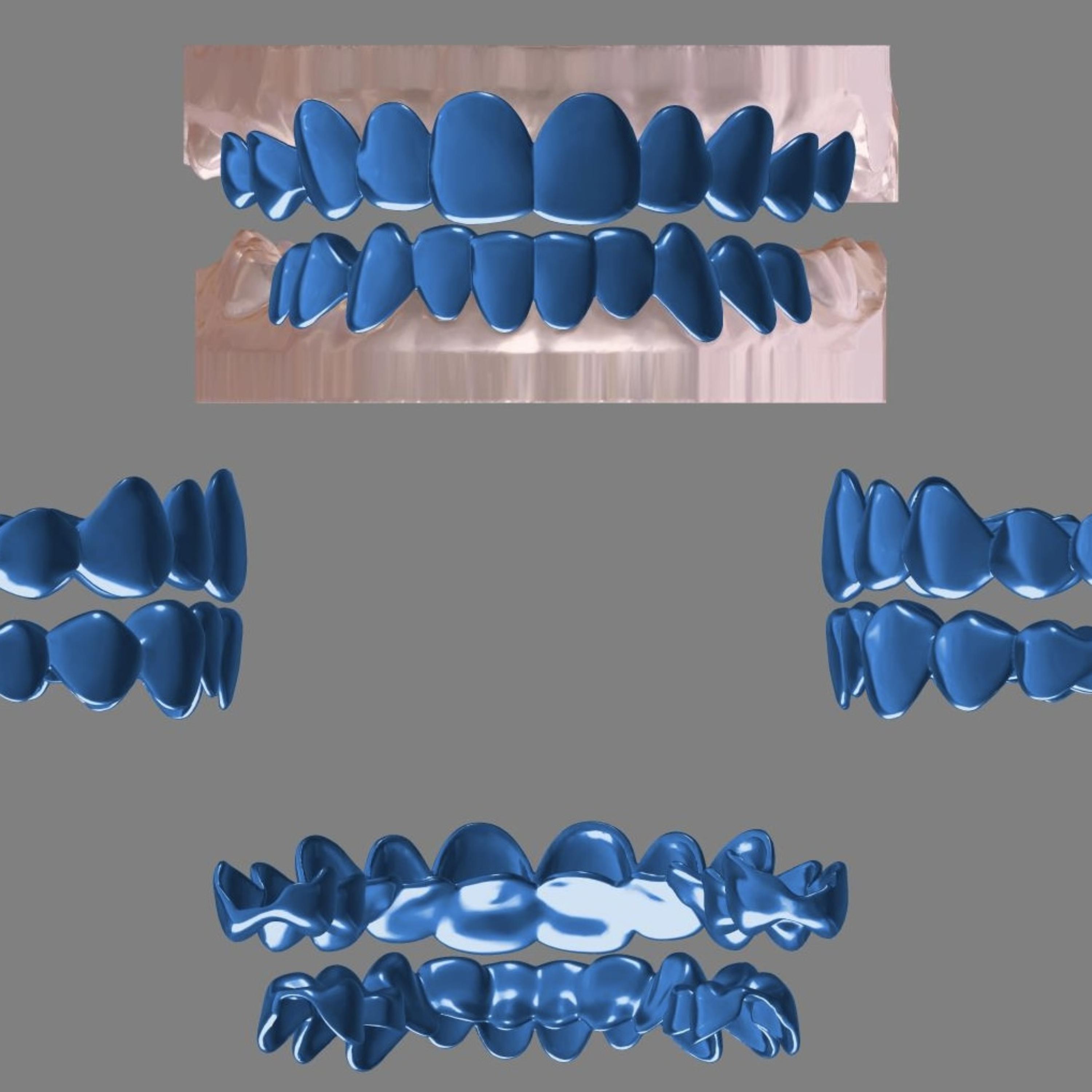 blue gold grillz by MMCris cover art
