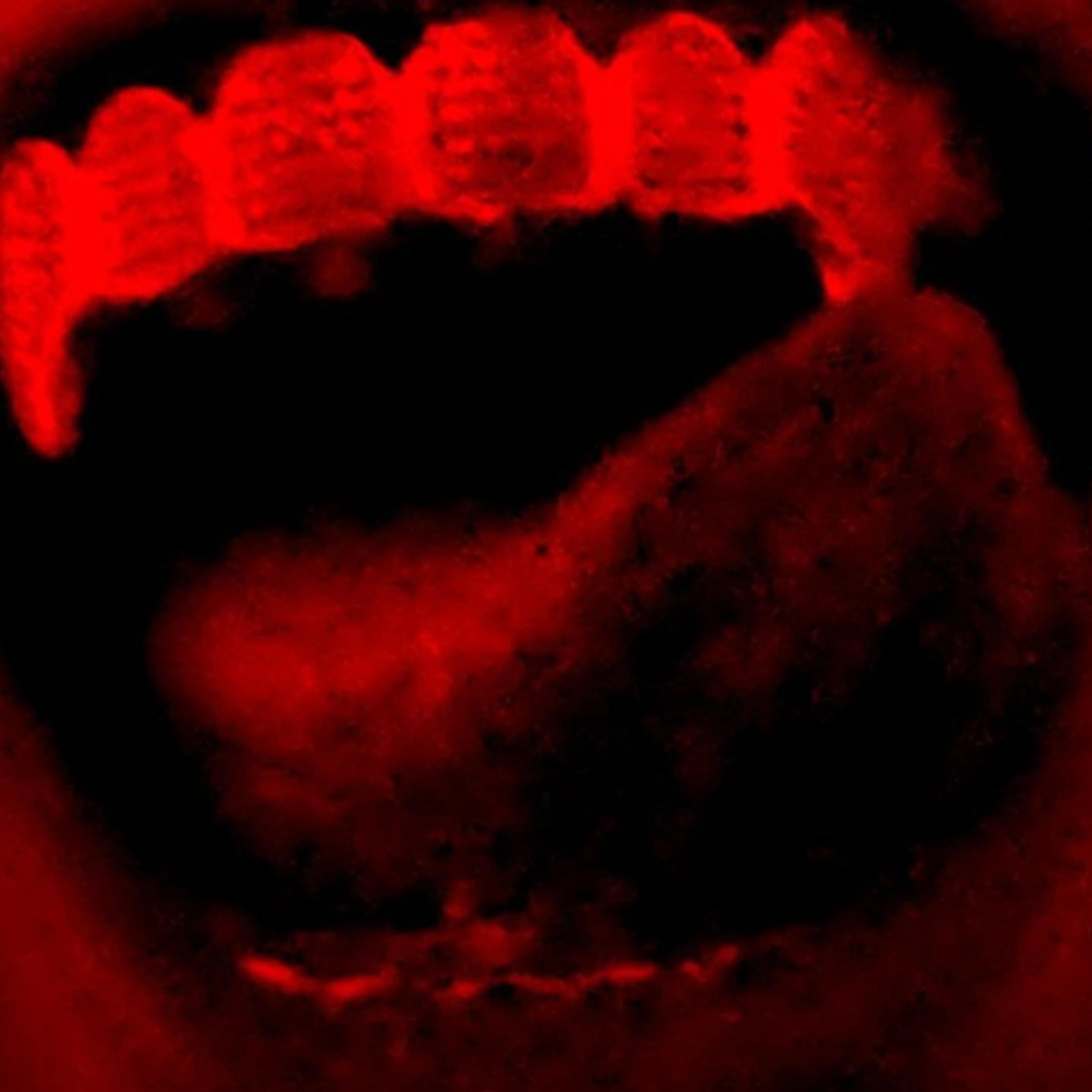 Turn It Into Anger (Chris's Version) artwork