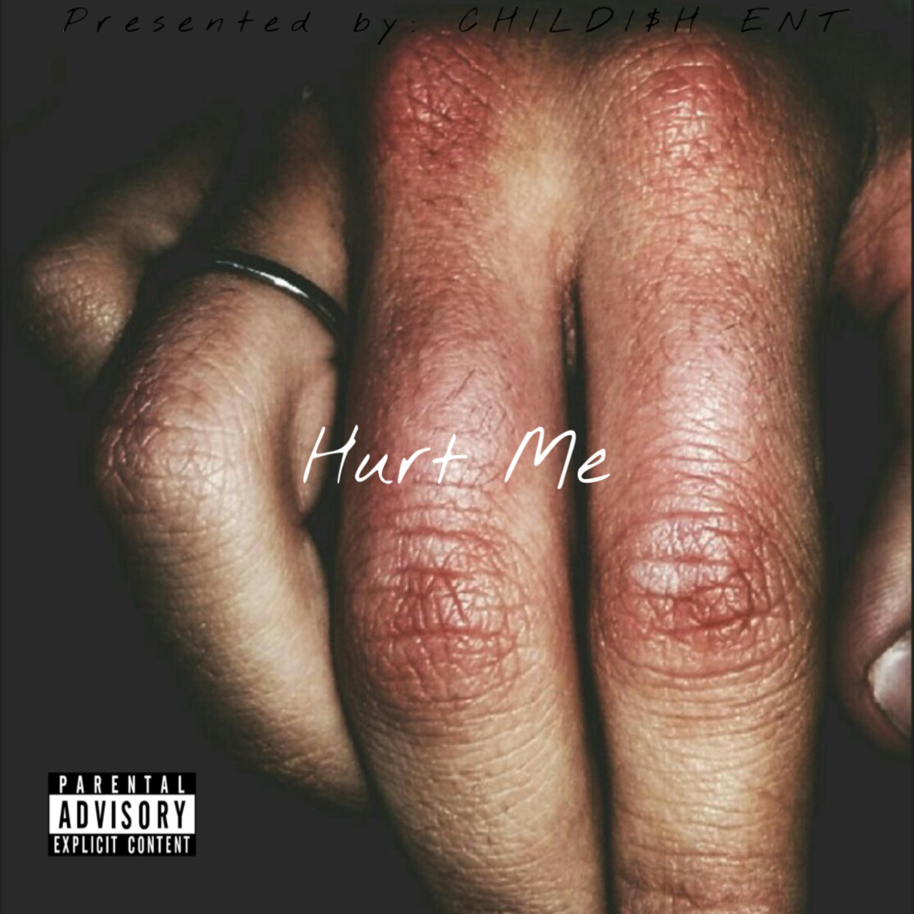 Hurt Me artwork