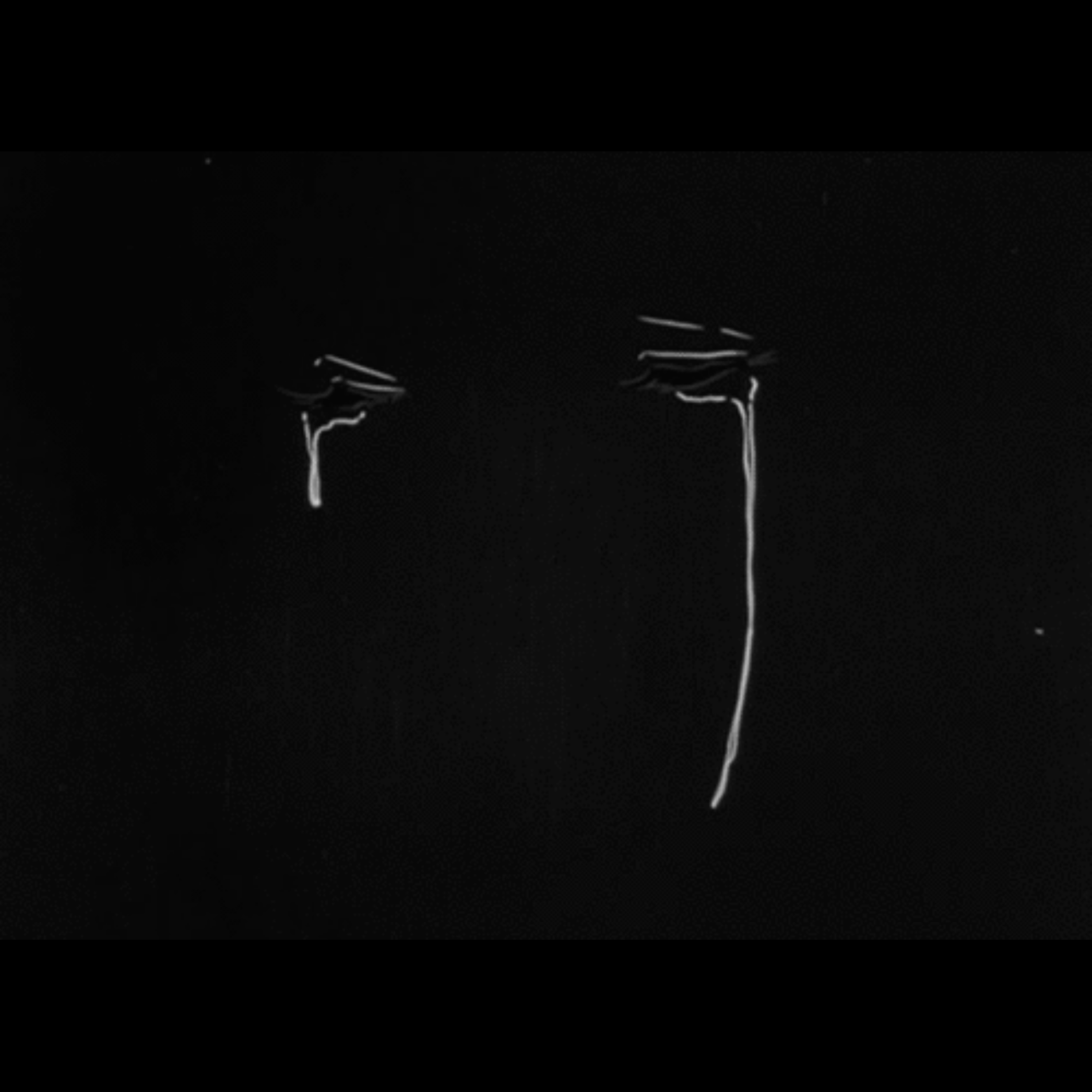 Tearsss artwork