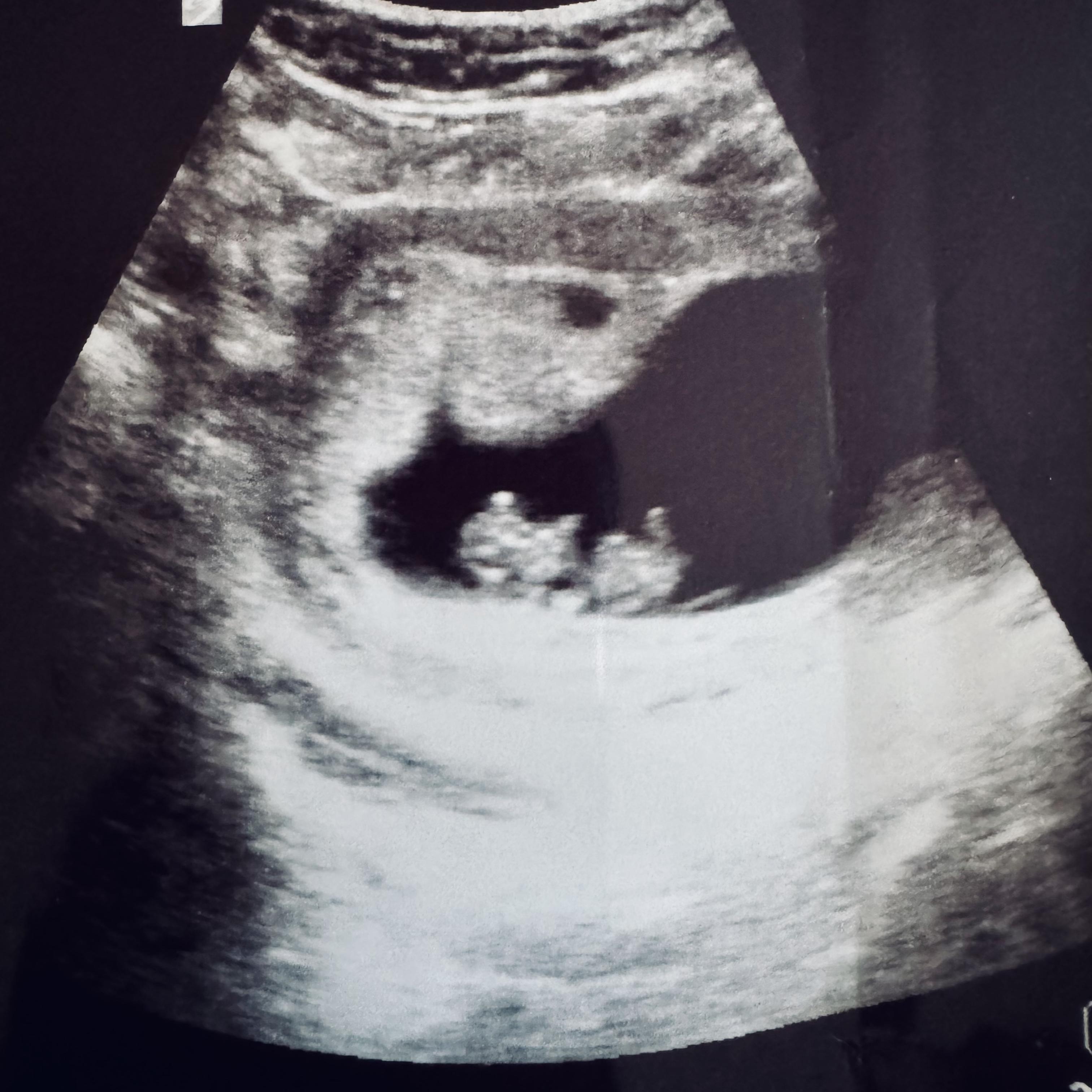 Made A Baby artwork