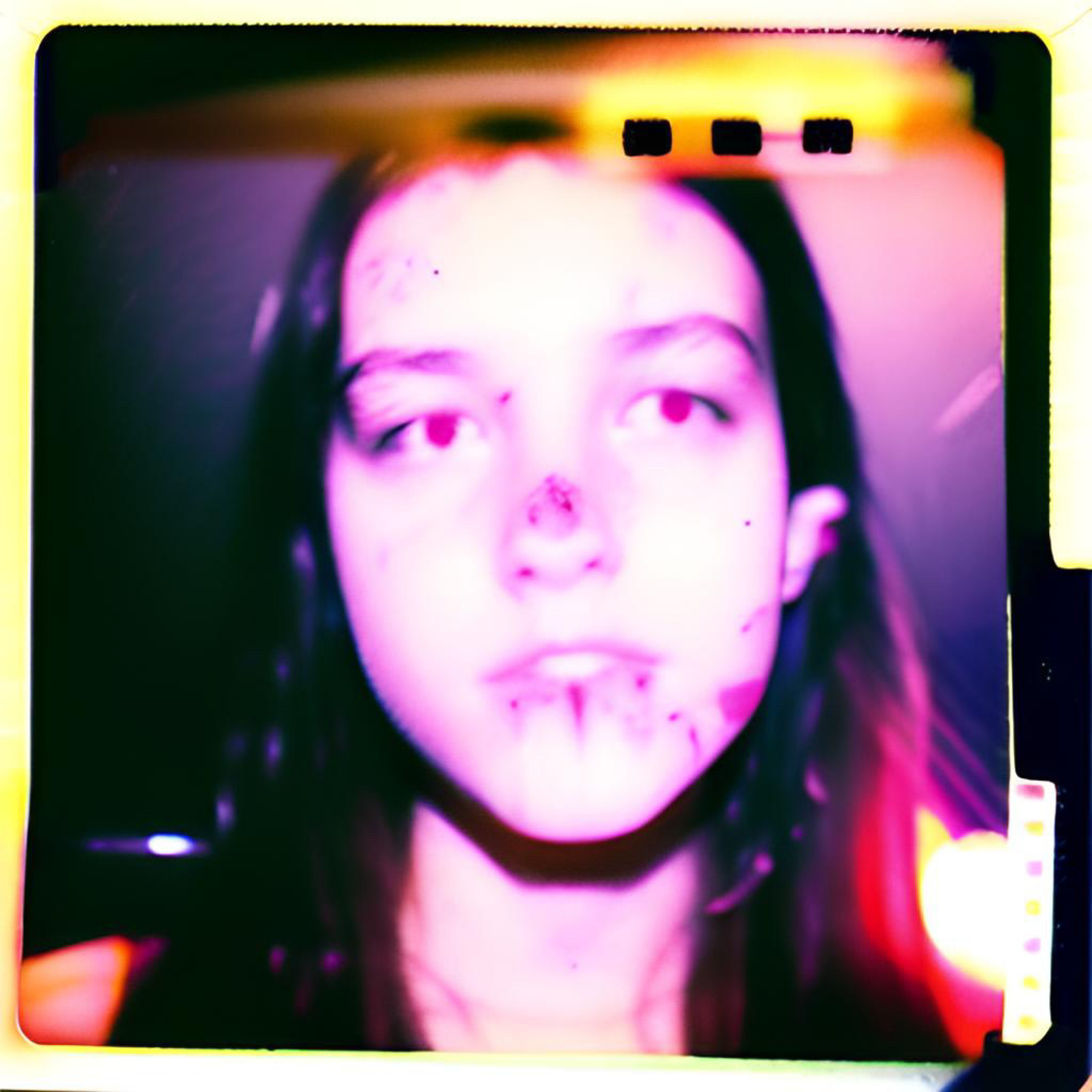 epaR (remix) artwork