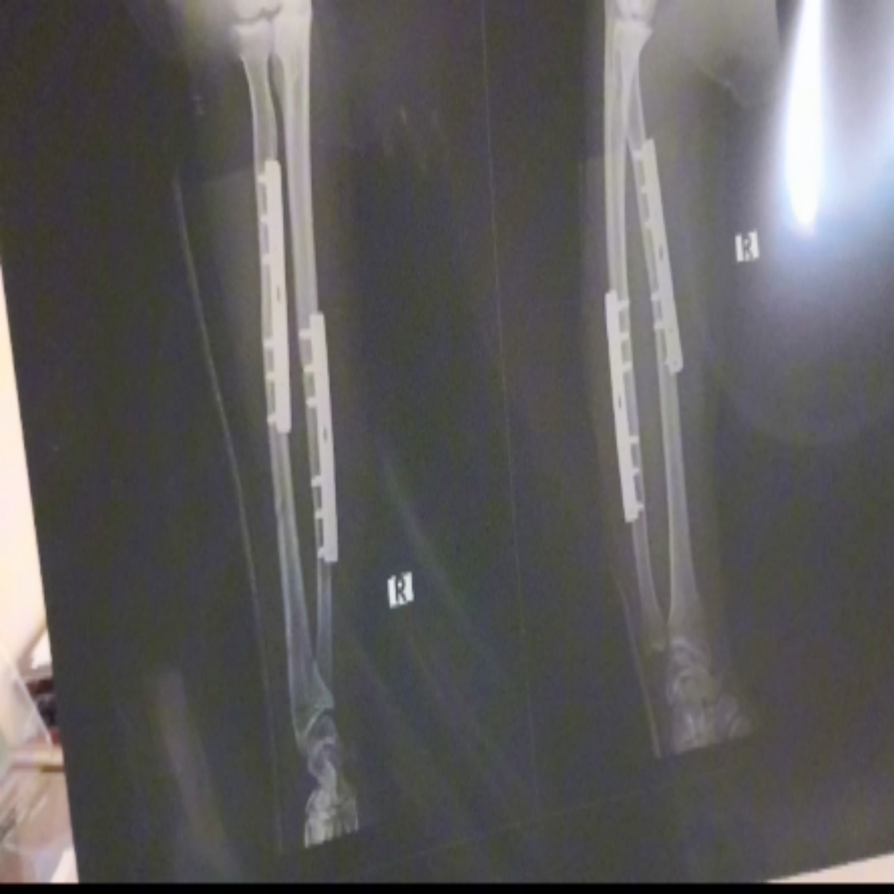 Man of Steel artwork