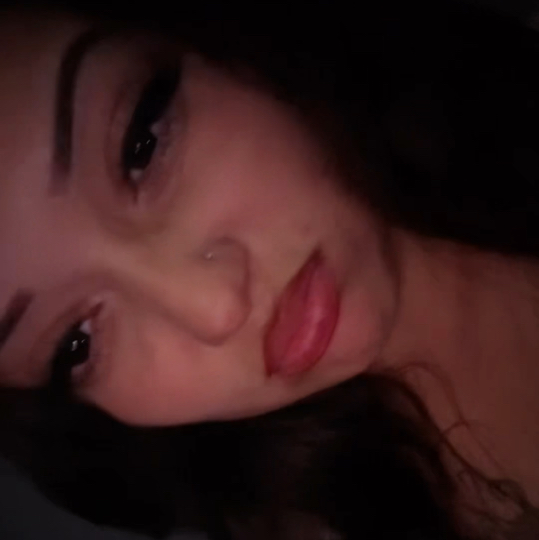 $Angeleye$